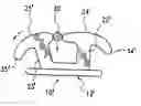 Fig. 01 - Shape memory self-ligating orthodontic brackets