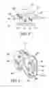 Fig. 04 - Shape memory self-ligating orthodontic brackets