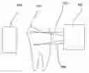 Fig. 01 - Infrared dental imaging