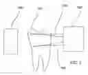 Fig. 02 - Infrared dental imaging