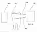 Fig. 03 - Infrared dental imaging
