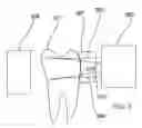 Fig. 06 - Infrared dental imaging