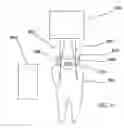 Fig. 07 - Infrared dental imaging