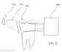 Fig. 08 - Infrared dental imaging