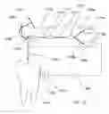 Fig. 12 - Infrared dental imaging