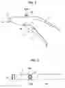 Fig. 02 - Pushing device for tooth restoration material mixed and kneaded in capsule