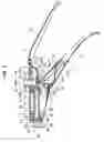 Fig. 03 - Pushing device for tooth restoration material mixed and kneaded in capsule