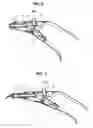 Fig. 04 - Pushing device for tooth restoration material mixed and kneaded in capsule