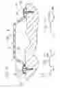 Fig. 03 - Device for regenerating, repairing, and modeling human and animal bone, especially in the jaw area for dental applications