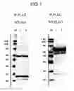 Fig. 02 - Interaction inhibitors, method of detecting interaction inhibitor and kit detecting interaction inhibitor