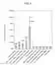 Fig. 07 - Interaction inhibitors, method of detecting interaction inhibitor and kit detecting interaction inhibitor