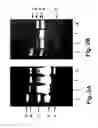 Fig. 03 - PROBES AND METHODS FOR IDENTIFYING POLYCYCLIC AROMATIC HYDROCARBON-DEGRADING MYCOBACTERIA