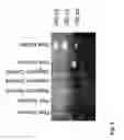 Fig. 11 - PROBES AND METHODS FOR IDENTIFYING POLYCYCLIC AROMATIC HYDROCARBON-DEGRADING MYCOBACTERIA