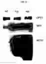 Fig. 04 - Phosphorylation of tau by abl