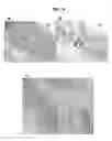Fig. 12 - Phosphorylation of tau by abl