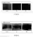 Fig. 06 - REDIFFERENTIATION MEDIUM FOR MAKING DEDIFFERENTIATED CHONDROCYTE TO BE REDIFFERENTIATED INTO CHONDROCYTE