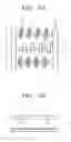 Fig. 03 - Microfluidic device and method for concentration and lysis of cells or viruses