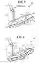 Fig. 03 - TRADITIONAL PUTTER WITH ELEVATED MASS