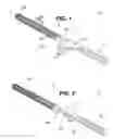 Fig. 02 - Weight securing system