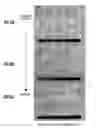 Fig. 07 - Aluminum nitride ceramic and semiconductor manufacturing member