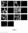 Fig. 05 - Peptides and methods using same for diagnosing and treating amyloid-associated diseases