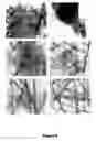 Fig. 06 - Peptides and methods using same for diagnosing and treating amyloid-associated diseases