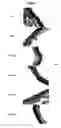 Fig. 03 - Follistatin isoforms and uses thereof