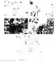 Fig. 13 - Method for diagnosis of alzheimer's disease