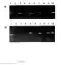 Fig. 14 - Method for diagnosis of alzheimer's disease