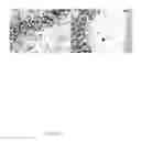 Fig. 16 - Method for diagnosis of alzheimer's disease