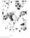 Fig. 17 - Method for diagnosis of alzheimer's disease