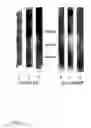 Fig. 18 - Method for diagnosis of alzheimer's disease