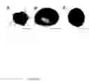 Fig. 19 - Method for diagnosis of alzheimer's disease