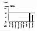 Fig. 04 - Method for assessing cancerous state