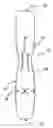 Fig. 01 - Blood vessel wrap