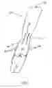 Fig. 03 - Blood vessel wrap
