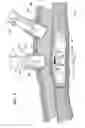 Fig. 07 - Lifting method for lesion area, and anchoring device