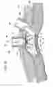 Fig. 08 - Lifting method for lesion area, and anchoring device