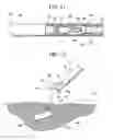 Fig. 09 - Lifting method for lesion area, and anchoring device