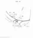 Fig. 04 - Colonoscopic device stabilizer