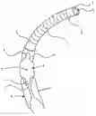 Fig. 01 - Alternating propulsion type endoscope and continuous drive type endoscope