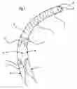 Fig. 02 - Alternating propulsion type endoscope and continuous drive type endoscope