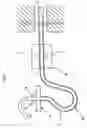 Fig. 03 - Alternating propulsion type endoscope and continuous drive type endoscope