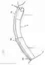 Fig. 08 - Alternating propulsion type endoscope and continuous drive type endoscope