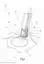Fig. 02 - Medical instrument and method for manipulating, in particular retracting tissue or an organ