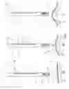 Fig. 03 - Medical instrument and method for manipulating, in particular retracting tissue or an organ
