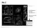 Fig. 03 - System and method for image based physiological monitoring of cardiovascular function