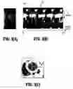 Fig. 04 - System and method for image based physiological monitoring of cardiovascular function