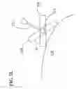 Fig. 12 - Methods and apparatus for guiding a needle