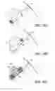 Fig. 06 - Methods and systems for marking post biopsy cavity sites